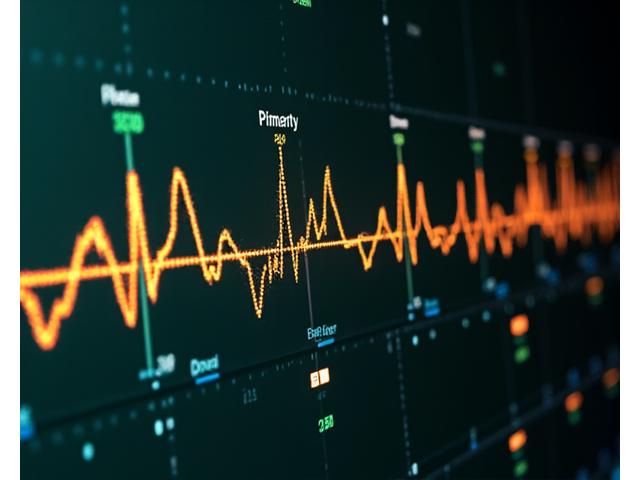 Graf variability srdcovej frekvencie (HRV) s farebnými bodmi označujúcimi zóny tréningu a zotavenia, prekryté jemným diagramom srdca.